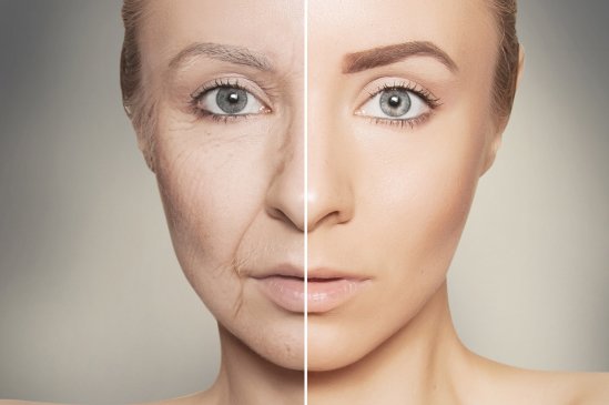 photoaging 549x365 Article Header Image mob
