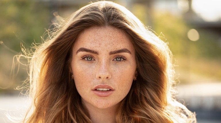 Как избавиться от веснушек и выглядеть безупречно